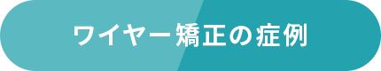 ワイヤー矯正の症例