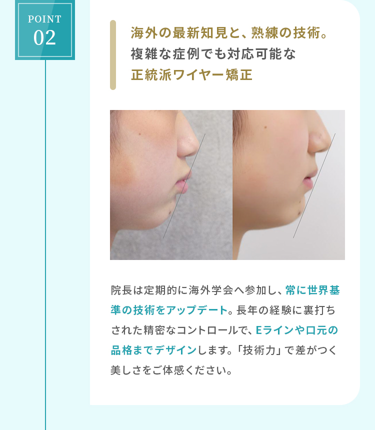 海外の最新知見と、熟練の技術。複雑な症例でも対応可能な正統派ワイヤー矯正